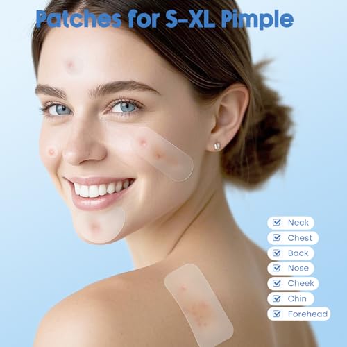 Pimple Patches for Face & Body,331 Patches Variety Pack w/ Large Sizes,Invisible Hydrocolloid Acne Patch with Tea Tree Oil & Salicylic Acid,Overnight Zit Stickers for Blemishes & Spots, All Skin Types