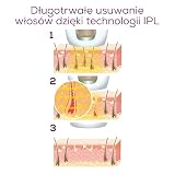 Beurer IPL 5800 Pure Skin Pro urządzenie do depilacji, trwałe usuwanie włosów dzięki technologii IPL, do ciała, twarzy, strefy bikini z aplikacją, kolor czarny