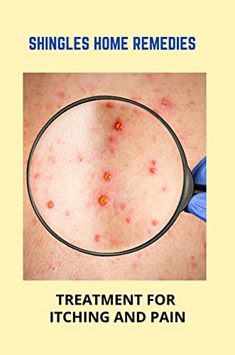 Shingles Home Remedies: Treatment For Itching And Pain: Shingles Recovery