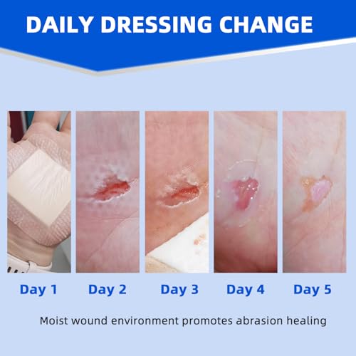 Niceful Silicone Foam Lite Dressing 3 x 3 in – Gentle Border Large Waterproof Bandages for Burns, Abrasions, Surgical Wounds – Medical Grade Wound Care Dressings for First Aid, Ultra Soft, 8 Count