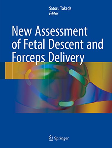 New Assessment of Fetal Descent and Forceps Delivery (English Edition)