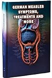 German Measles Symptoms, Treatments and More: Learn about German measles, including symptoms and available treatments. Educate yourself on this viral infection for informed health decisions.