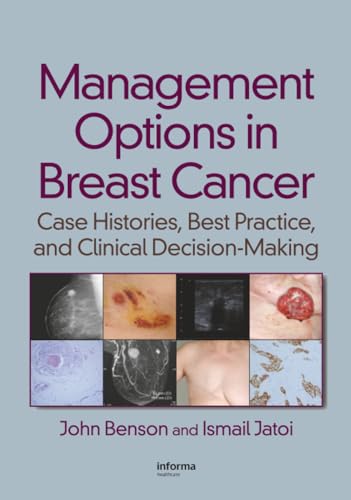 Management Options in Breast Cancer