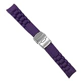 (COMPATIBILIDAD): estos modelos tan especiales de correas antiguas son compatibles tanto en los bonitos relojes vintages como en la relojería moderna, podrás usarlos en cualquier tipo de reloj. Asegúrate del ancho de la correa de tu reloj antes de realizar el pedido.