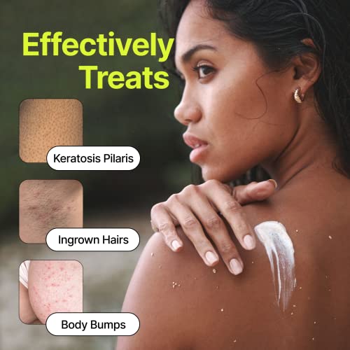 Tropic Labs White Sands Dual-Action Body Scrub - Sensitive Skin Exfoliating Treatment For Keratosis Pilaris, Strawberry Legs, Bikini Bump Eraser, Body Care For Women 6.4Oz. #TOP2