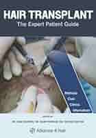 Hair Transplant - The Expert Patient Guide: Mentrup, Ludger