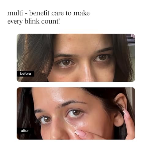 Image of Aminu Eye Serum - Peptide, Caffeine, HA + 15 Actives for Dark Circles, Puffiness, Wrinkles, Fine Lines