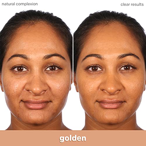 Almay Clear Complexion Acne Foundation Makeup With Salicylic Acid - Lightweight, Medium Coverage, Hypoallergenic, Fragrance-Free, For Sensitive Skin, 710 Natural Tan, 1 Fl Oz. #TOP6