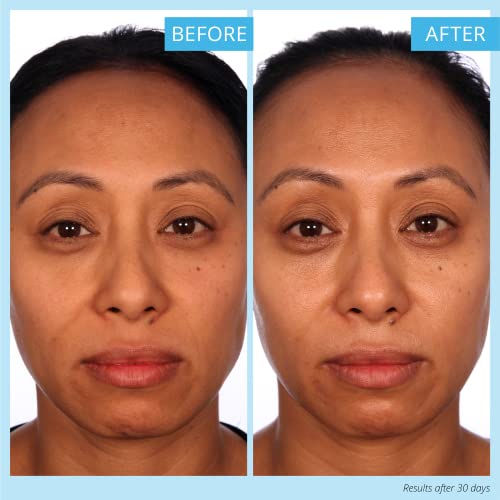 Skinn Luminous Firming Cream - Facial Skin Care Cream Improves Elasticity, Plumps And Lifts Sagging Skin - Maintains Hydration To Reduce Fine Lines, Wrinkles And To Strengthen Skin’s Barrier Function - Vitamin C And Manuka Honey #TOP3