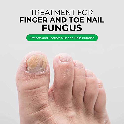 Antifungal Nail Fungus Treatment for Finger & Toe Nail- 1 Fluid Ounce