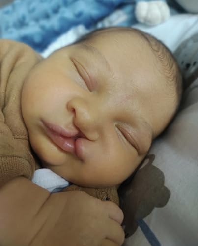 Building Community Through Cleft Motherhood: A Greek Mom's Cleft Journey