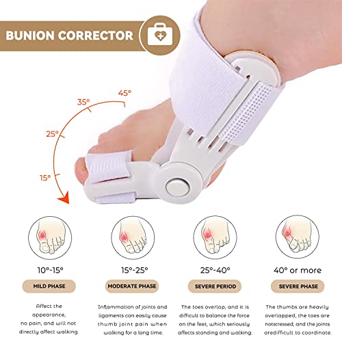 Qiefarm Bunion Corrector For Women/Men, Toe Separators Effective Pain Bunion Relief Bunion Pads Adjustable Toe Spacers, Exercise Strap For Hallux Valgus Correction(4Pcs) #TOP2