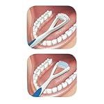 GUM Tongue Cleaner - Dual Action Soft Bristled Tongue Brush with Tongue Scraper for Better Oral Hygiene - Bad Breath Treatment (Pack of 3) - Image 4