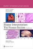 Biopsy Interpretation: The Frozen Section (English Edition)