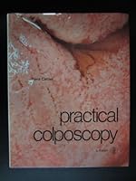 Practical Colposcopy 3805528086 Book Cover