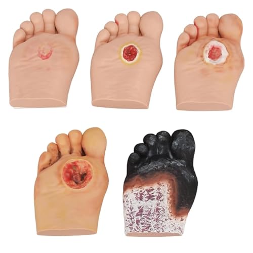 Model symulatora pielęgnacji stóp cukrzycowych – ropne zmiany ran stopnia 1-5 do anatomii, fizjologii i demonstracji pielęgnacji ran