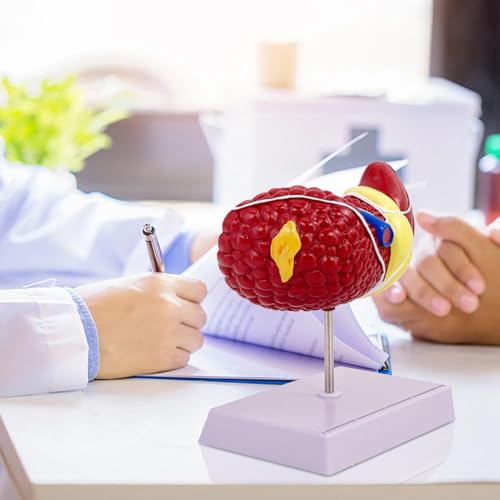 Modèle anatomique du foie pour expliquer les maladies aux patients - 2