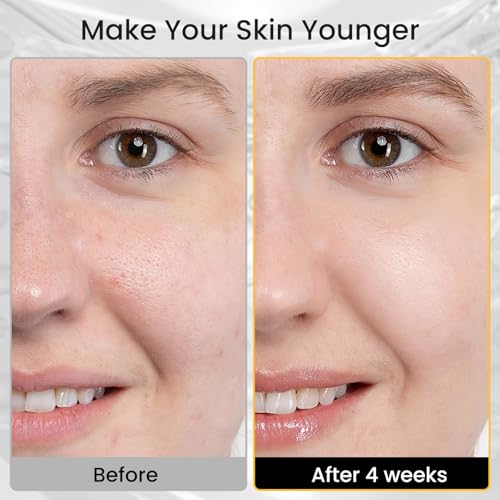 Iarha Red Light Therapy For Face, 8 Colors Led Face Mask Light Therapy With Timing Function, Led Face Mask Light Therapy At Home 240 Led Beads (Black+Gold) - 2