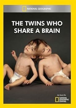 DVD National Geographic: The Twins Who Share a Brain Book