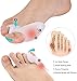 PediGoo Bunion Corrector Pain Relief Deluxe Kit - Fast Bunion Sleeves Pad with Gel, Pedicure Toe Separators Spacers, Exercise Toe Strap Straightener - 11 Pieces - One Size Fits All