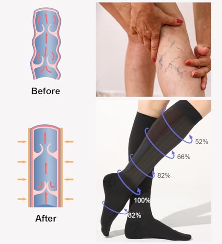 2 Pares Medias de Compresión Mujer y Hmbre Médicas Circulacion, 20-30 mmHg Clase 2, Calcetines Compresion para Varices, Edema, Vuelo (Negro+Beige, L) - imagen 3