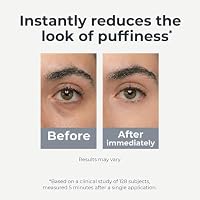 Under Eye Brightener Roller - Caffeine & Retinol Eye Serum for Dark Circles, Puffiness & Fine Lines, Travel Essential Vegan Skincare, Cooling Eye Massage, Dermatologist-Tested, 0.52 fl oz — image 4