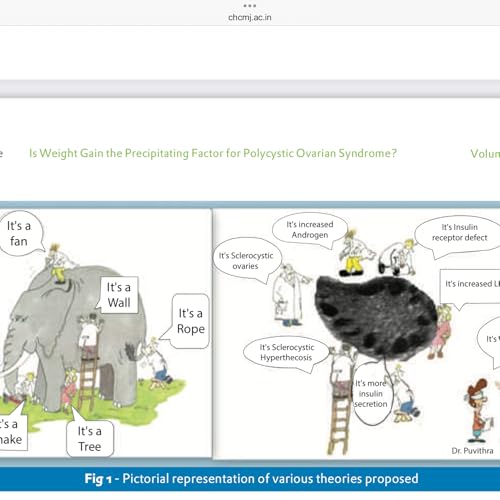 Page de couverture de Rethinking Polycystic Ovary Syndrome. PCOS. Is PCOS an Epiphenomenon