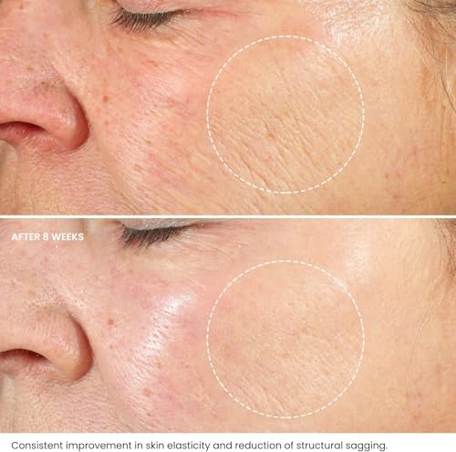 Roxanna Retinol Cream for Face 50ml, Anti Wrinkle Cream Retinol Moisturizer - Image 4