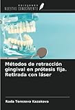 radar fijo maps  Métodos de retracción gingival en prótesis fija. Retirada con láser