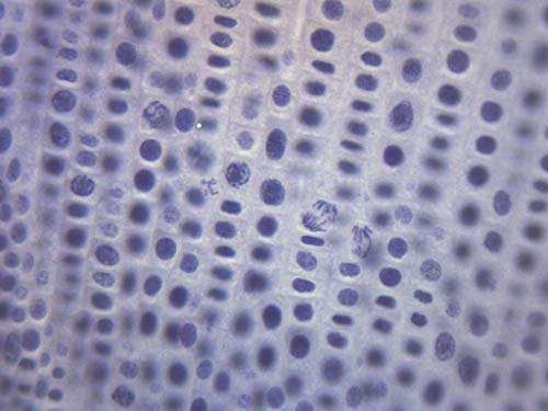 EISCO Onion Mitosis, Prepared Microscope Slides - 75 x 25mm - Classroom Pack, 10 Slides in Storage Case - Plant Mitosis, Introductory Microscopy