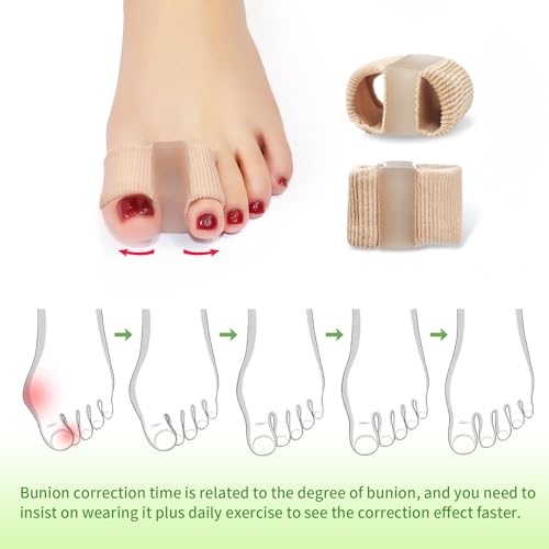Niupiour Gel Bunion Toe Separators W/Fabric Lining for Big Toe, Silicone Toe Spacers Bunion Correctors for Overlapping Toe, Breathable Toe Corrector Protector for Women and Men, Relieve Foot Pain