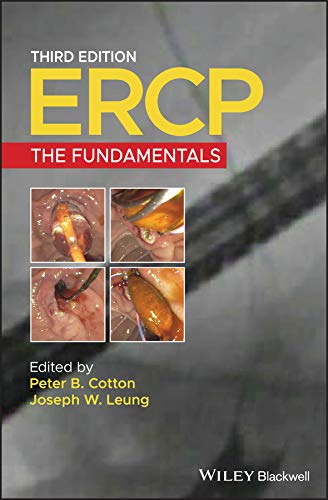 ERCP: The Fundamentals (English Edition)