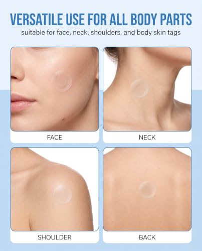 IPNSDON Patchs micro-aiguilles pour acrochordons, dissolvants sans douleur, enlèvent efficacement acrochordons, verrues, boutons visage, cou, dos et corps, anti-acné et points noirs – vue 5