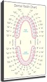 JMVLVLOA Dental Teeth Chart Posters - Wall Art Canvas Prints for Clinic Decor - Professional Decor for Dental Office and Practice(Unframed,12x18inch(30x45cm))