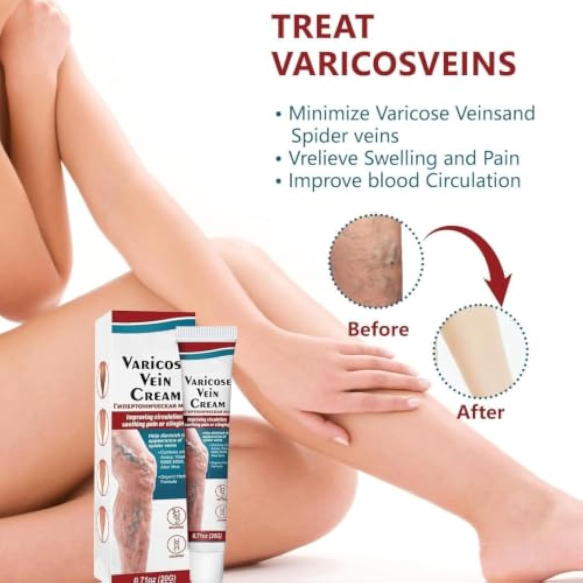 Varicose Veins Cream for Legs, Moisturizing Leg Care