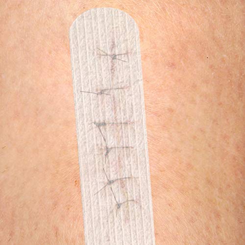 ARTIBETTER 6 PeÃ§as de Fechamento de Ferida Com Adesivo de Pele para RemoÃ§Ã£o de Cicatriz Adesivo d