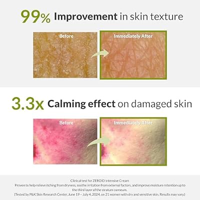 ZEROID Intensive Cream and Soothing Cream Bundle