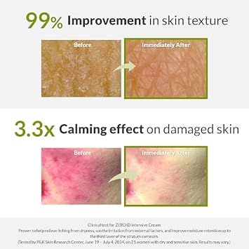 ZEROID Intensive Cream and Soothing Cream Bundle
