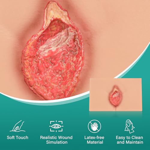 Image of Decubitus Ulcer Care Model, Bedsores Model
