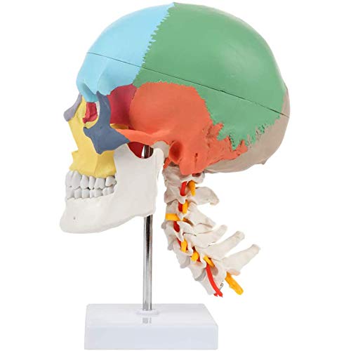 Crâne humain modèle d'araignée cervicale coloré 3 pièces avec base