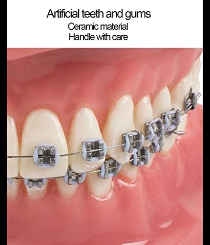 Modelli di Denti per Studenti di Odontoiatria, Modello Dentale Modello Ortodontico con Apparecchi in Ceramica E Metallo, Ottimo per L'insegnamento Scolastico E L'apprendimento degli Studenti, Mate