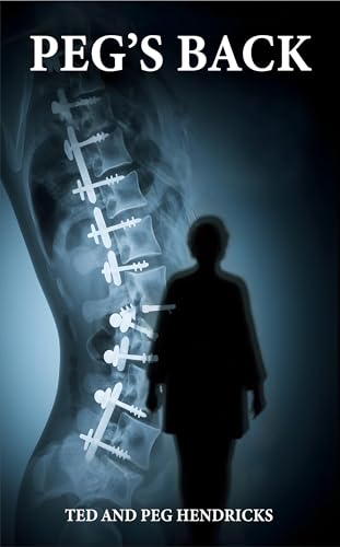 Peg’s Back