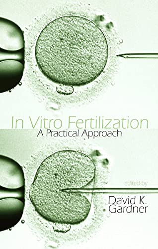 In Vitro Fertilization: A Practical Approach