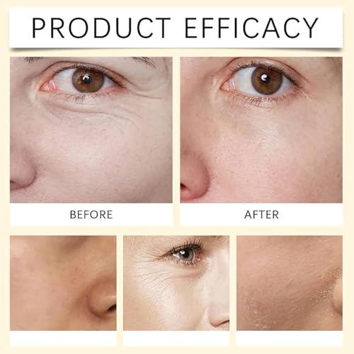 2 Pcs Polypeptide Collagen Elastic Essence Cream, Micro-Molecular Collagen Lotion, Firming Cream Tightening Lifting