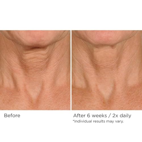 NassifMD Deco-Lift Neck & Decollete Firming & Lifting Complex