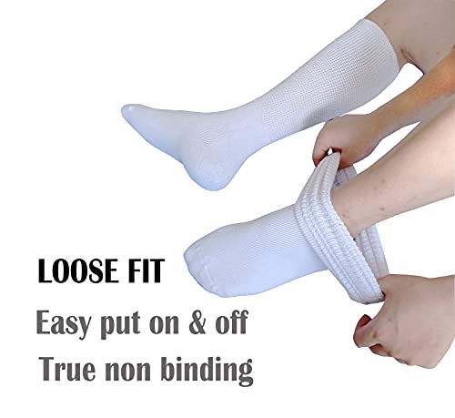 Extra Wide Socks For Lymphedema Swollen Feet Leg, Bariatric Socks, Medical Cast Sock, Diabetic Non Binding Socks – Oversized Neuropathy Swelling Feet Socks For Women Men Over Calves (2 Pairs(White)) #TOP5