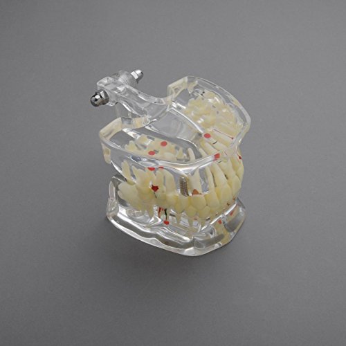 J&J Ortho General Adult Pathology Dental Model