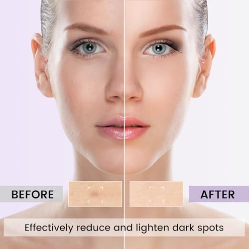Jacrynth Dark Spot Remover for Face and Body,Dark Spot Corrector for Age Spots and Brown Spots,Advanced Formula with and Hyaluronic Acid and Vitamin C