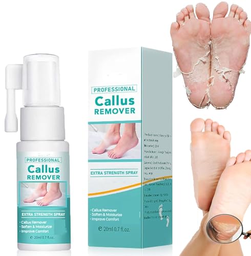 Spray profesional para eliminar callos extrafuerte, espray para eliminar callos de pies, espray removedor de callos de pie y talón, aceite en aerosol para eliminar la piel muerta y los callos en los