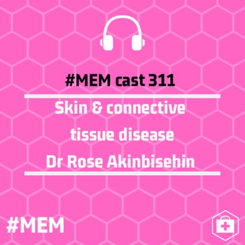 Episode 315: Skin and connective tissue disease